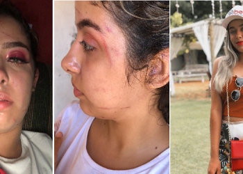 Digital influencer afirma que foi agredida por três mulheres no Piauí